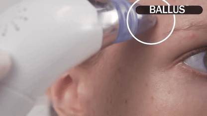 Facial Steamer